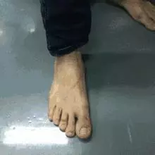 人之衰老,肝為先導,滋肝養肝「三步走」,肝好一切都好!
