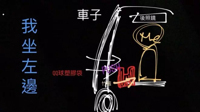 屁股上直挺挺「插一根」!護理師嘖嘖稱奇:角度這麼準進去也不容易