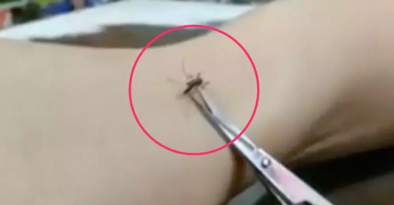 他趁蚊子吸血吸超爽時拿剪刀靠近,神手一剪後出現的「超狂畫面」讓40萬網友High爆了!