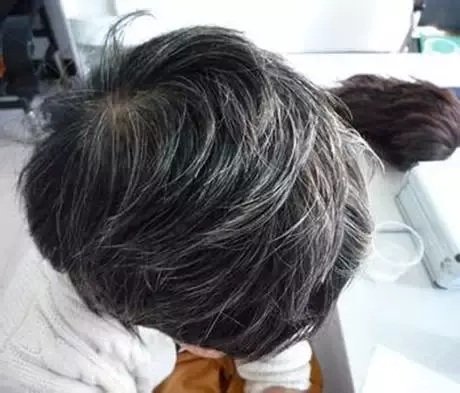 人體有一條「經」很神奇!竟能夠敲掉脂肪,媽媽每天敲幾次居然瘦了4公斤!連白頭髮都沒了!