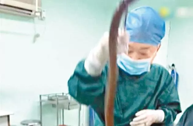 強國男信偏方,半米黃鱔塞肛門通便險死,打開腹腔醫生,這條黃鱔竟然已經~
