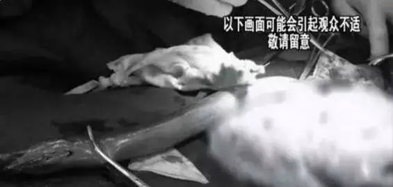 強國男信偏方,半米黃鱔塞肛門通便險死,打開腹腔醫生,這條黃鱔竟然已經~