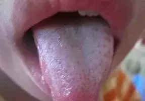 脾胃越調越虛?原因可能在這裡!