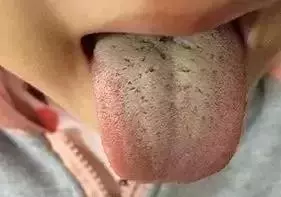 脾胃越調越虛?原因可能在這裡!