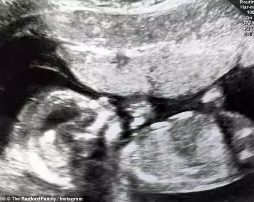 英國 43 歲超級媽媽 30 年生了 21 個孩子