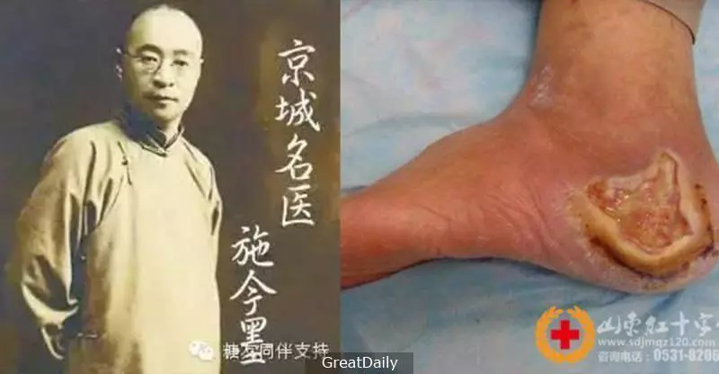 超強中國四大名醫的糖尿病驗方,沒有一個病患高血糖是救不回來的,不想吃藥一輩子的一定要看一看