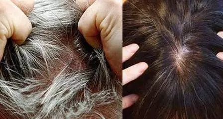 頭髮白了別再反復去染,對身體傷害太大了,簡單的幾招洗髮步驟,烏黑亮髪更顯年輕!!