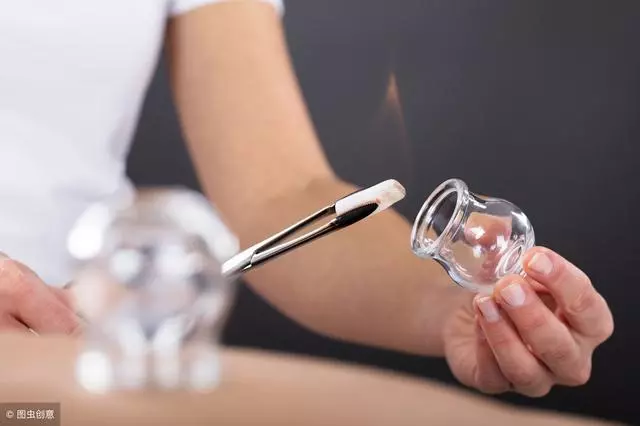 拔罐祛濕氣?要選「2個」穴位,不然祛濕沒效果