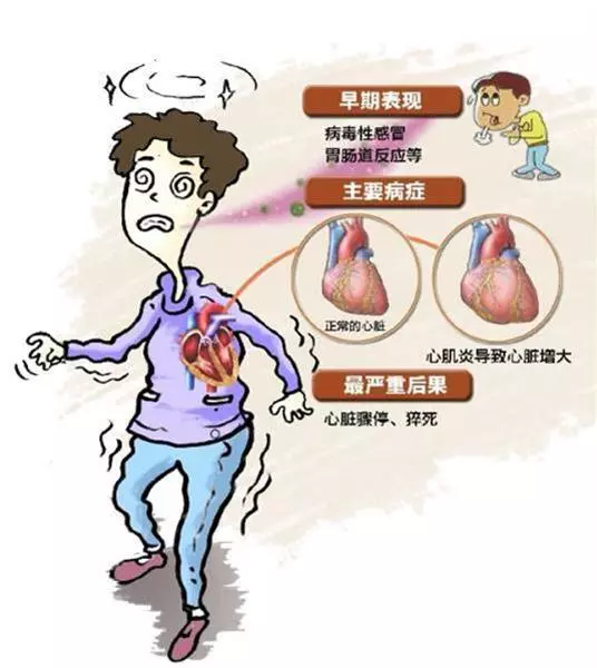 頭痛、發熱,你還以為症狀是感冒嗎??它可能是讓你致命的絕症!