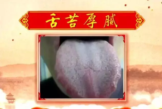 早餐前這樣動一動,健康防百病,老中醫每天都做,身體倍棒!