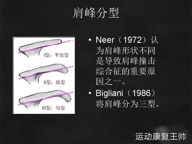 肩峰撞擊綜合徵,看康復師如何給你分析的透透的