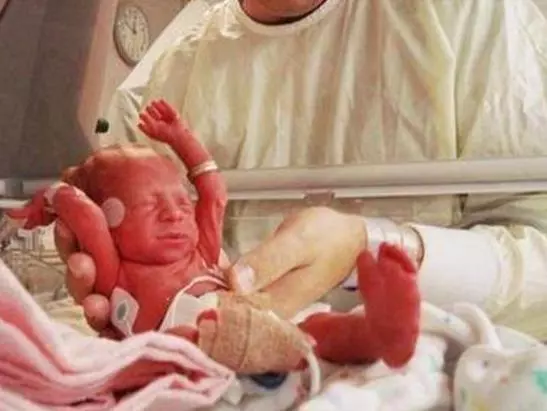 流產8次,第9次懷孕醫生勸孕婦打掉,孩子出生後,護士嚇得不敢抱!
