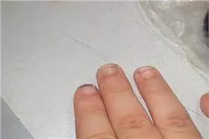 寶寶的指甲會「說話」,遇到這4種狀況不能忽視,寶媽來看看