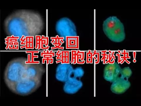 1年內治好癌症!讓癌細胞〝變回〞正常細胞的秘訣!
