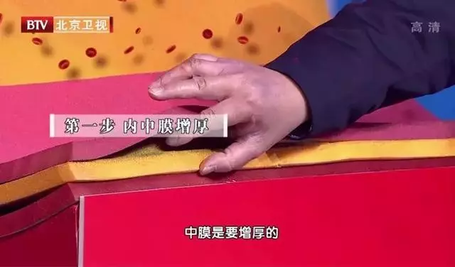 55歲體檢正常,三年後卻突發心梗,醫生稱:番茄炒蛋是「元兇」,很多中老年人都這麼吃!