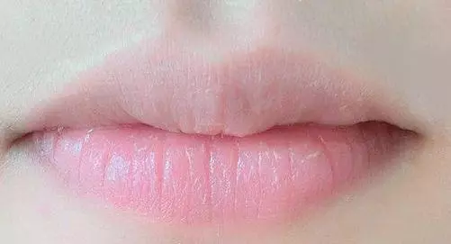 中醫怎麼從唇色「讀」身體的?一次性全都教給你