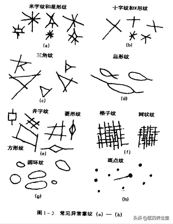 一口氣讀懂中醫手診,通俗易懂!收藏下來吧