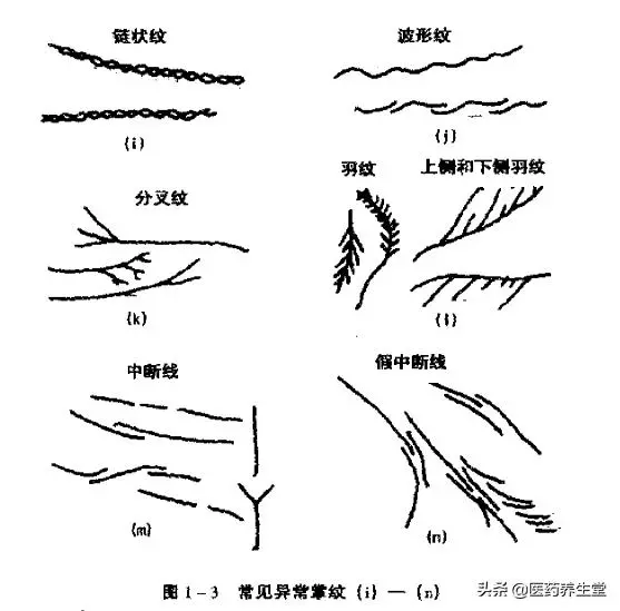 一口氣讀懂中醫手診,通俗易懂!收藏下來吧