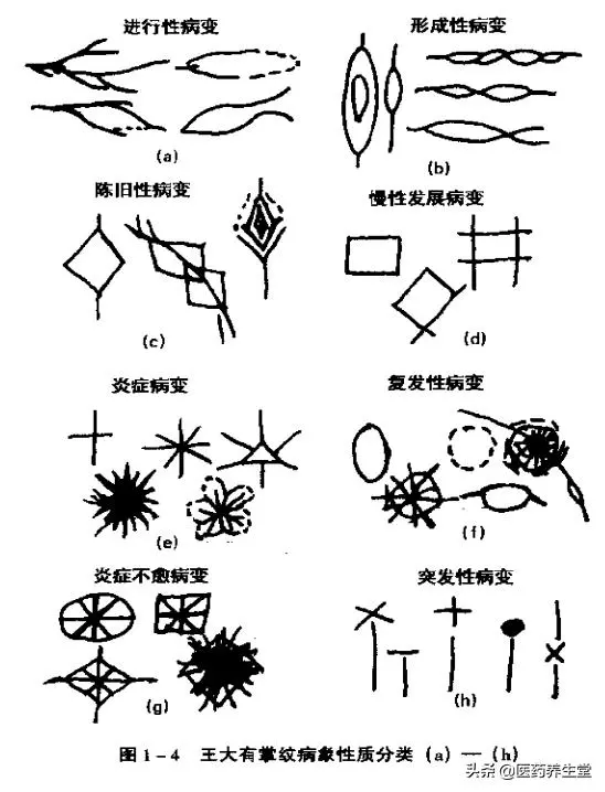 一口氣讀懂中醫手診,通俗易懂!收藏下來吧
