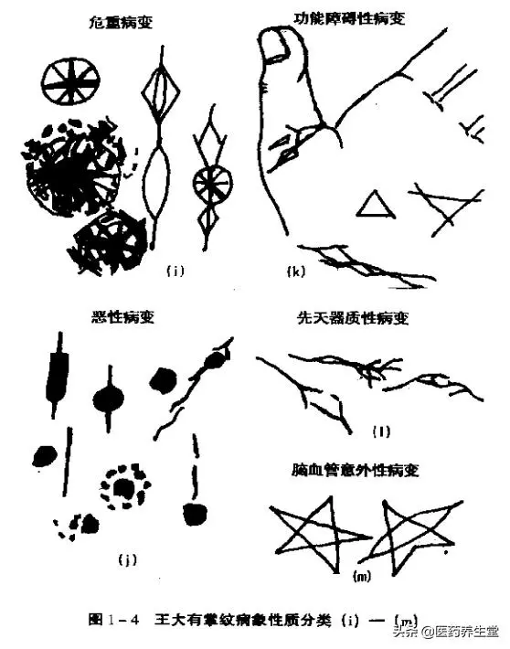 一口氣讀懂中醫手診,通俗易懂!收藏下來吧