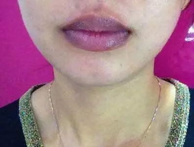 肝不好,臉先知,一旦肝臟受損,勸你2件事少做,3樣食物要少碰!