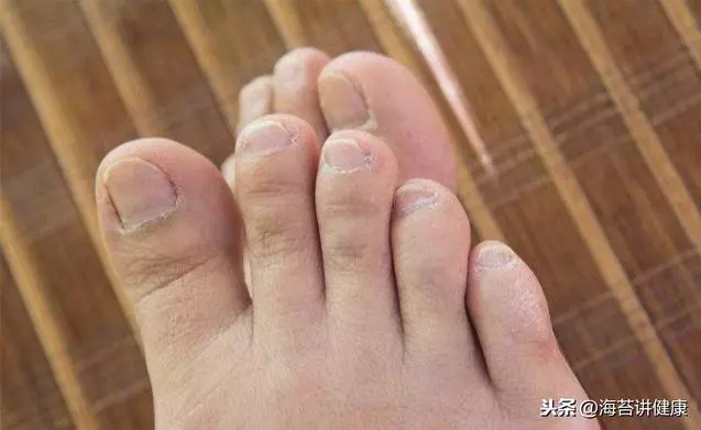 45歲以後,血管好不好「先看腳」,戒掉2事,血管健康人長壽