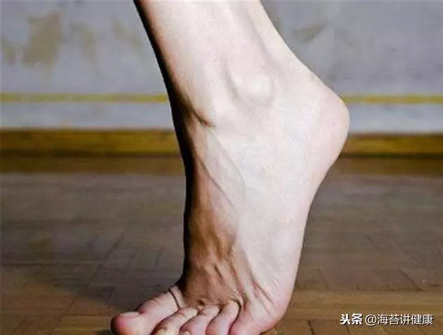 45歲以後,血管好不好「先看腳」,戒掉2事,血管健康人長壽