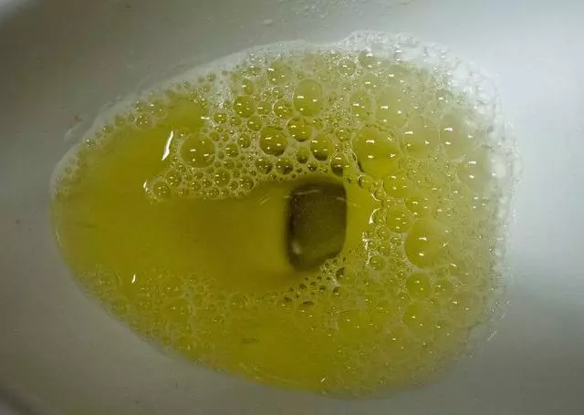 老中醫說: 通過看指甲你就會知道, 可能是患上了糖尿病, 看過都說准!