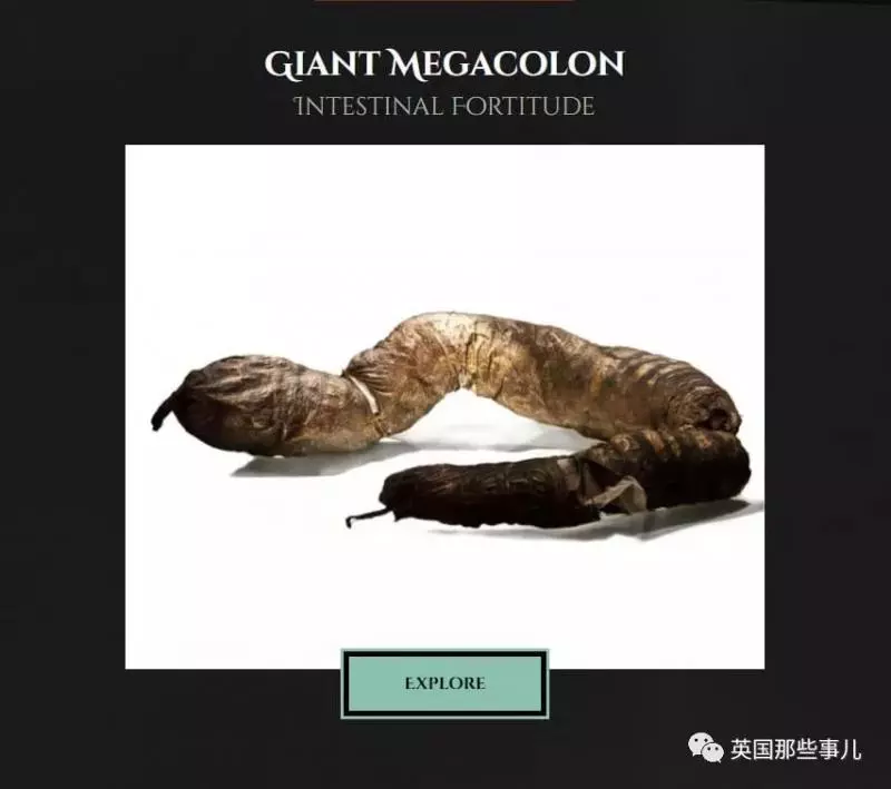 他是「全世界擁有最大啤酒肚」的男性,在他離世後,醫生剖腹竟發現原來他肚子裡裝的都是「這些」!