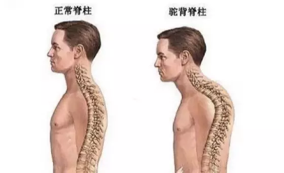 太棒了!只要做這五個動作...背痛,腰痛,頸椎痛都好了!老實做一周我整個人挺起來!