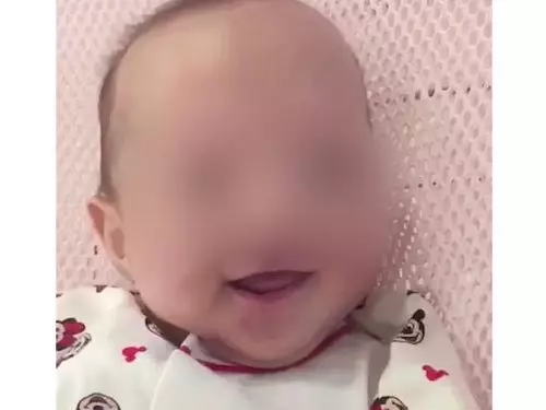 奇跡寶寶!懷胎6個月的孕婦被羅裡撞死,緊急剖腹救嬰兒!孩子爸爸:感謝醫院創造奇跡!
