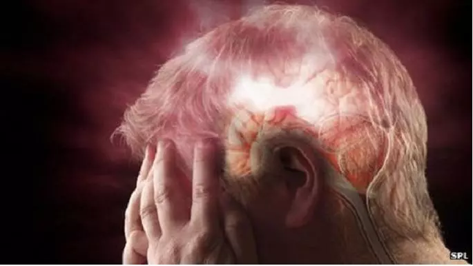 腦中風發生前,會出現 這6個徵兆!為了家人健康,把握 黃金救命時刻...