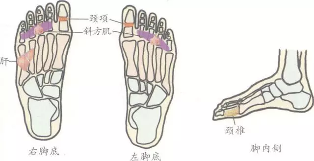 落枕,失枕,項背部酸痛,頸部活動受限?7個手足反射區有效果,收藏