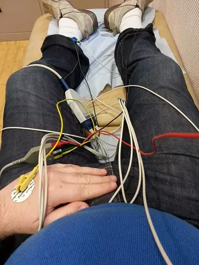 繞了9次鬼門關又回來!29歲「九命男」每天活得像沒有明天:走太快就掰了