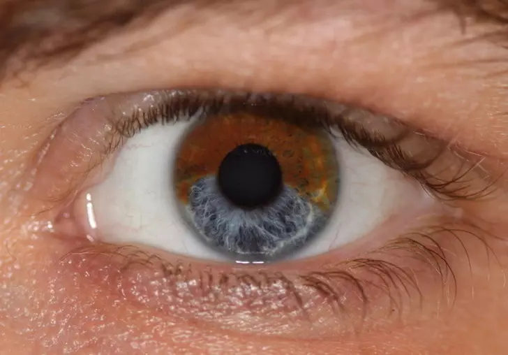 為什麼有些人眼睛是紫色的?7個讓你「眼睛變色」的小方法 進食習慣、情緒都會影響!