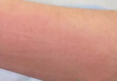 醫生提醒:睡覺時有這種表現就是中風前兆!一定要警惕