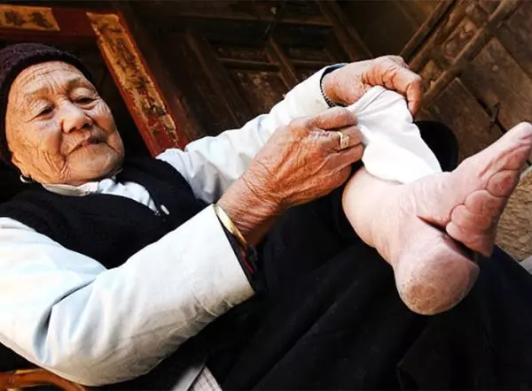 揭開三寸金蓮血淚史!終於願意「鬆開裹腳布」用X光看驚悚到像是P出來!