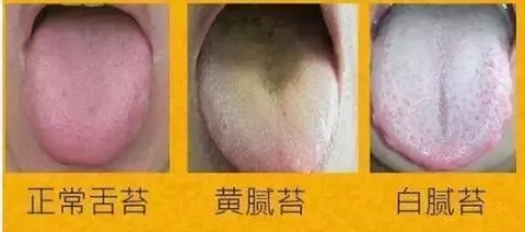 從舌頭一眼看是否癌症體質,癌細胞最怕1種鹼性食物,常吃防癌
