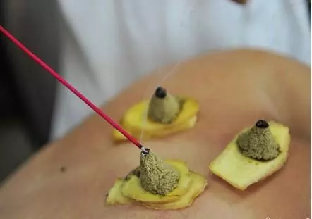 年底聚會多,腹瀉、胃痛、消化不良找上門怎麼辦?