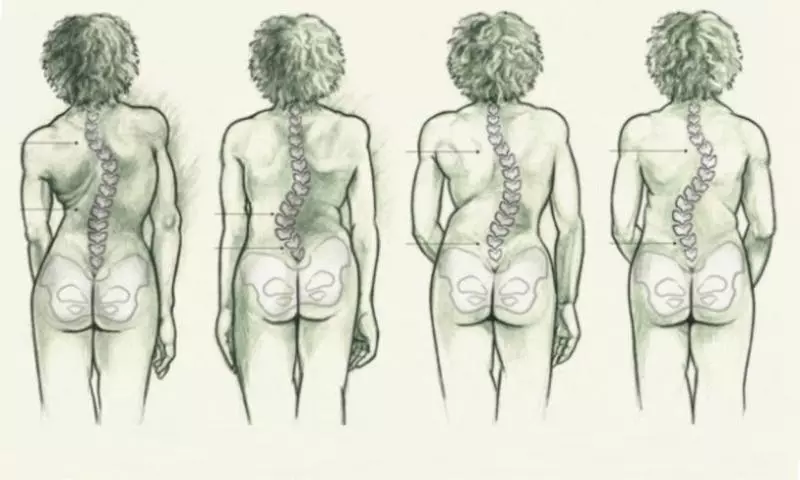 學起來吧:「咬」上【一根吸管】,走兩步轉轉頭,不僅矯正姿勢、還能改善你長久的腰痠背痛,為家人收好