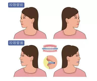 學起來吧:「咬」上【一根吸管】,走兩步轉轉頭,不僅矯正姿勢、還能改善你長久的腰痠背痛,為家人收好