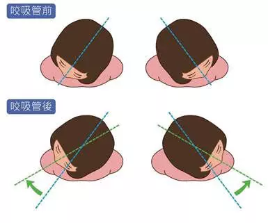 學起來吧:「咬」上【一根吸管】,走兩步轉轉頭,不僅矯正姿勢、還能改善你長久的腰痠背痛,為家人收好