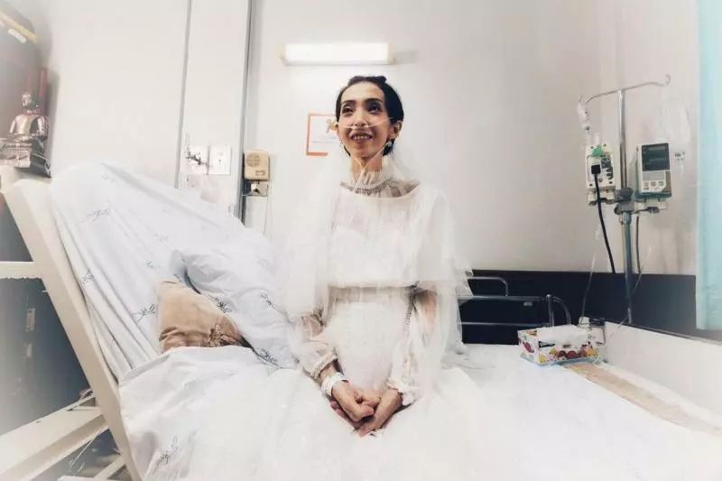 女友「病重不成人形」男友堅持病房完婚:「只想珍惜此刻…」引網鼻酸~ (內有視頻!)