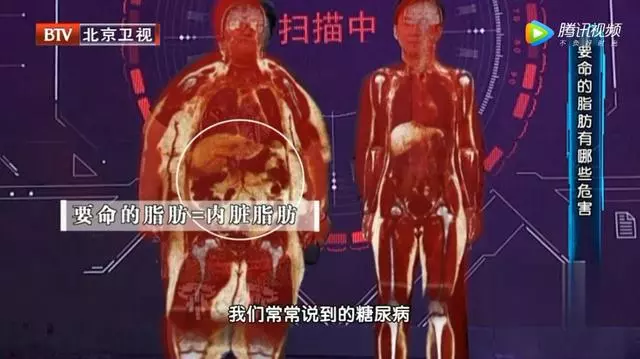 脂肪長在這裡最危險,看不見的肥胖更致命!簡單兩招,讓你快速瘦!