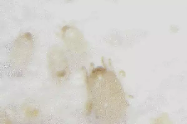 一周皮屑量居然可以養活300萬蟎蟲!告訴你1個不花錢的簡單除蟎法!