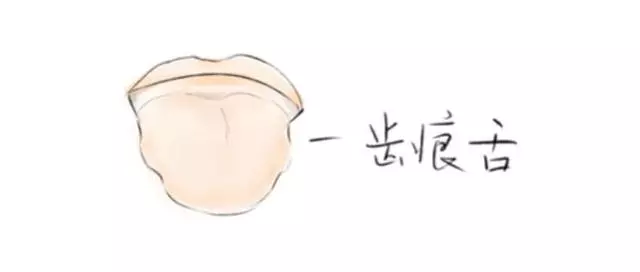 齒痕舌,我一定要戰勝你