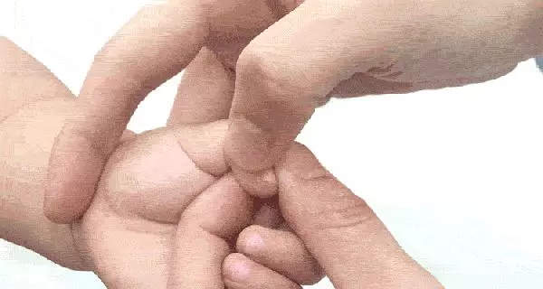 齒痕舌,我一定要戰勝你