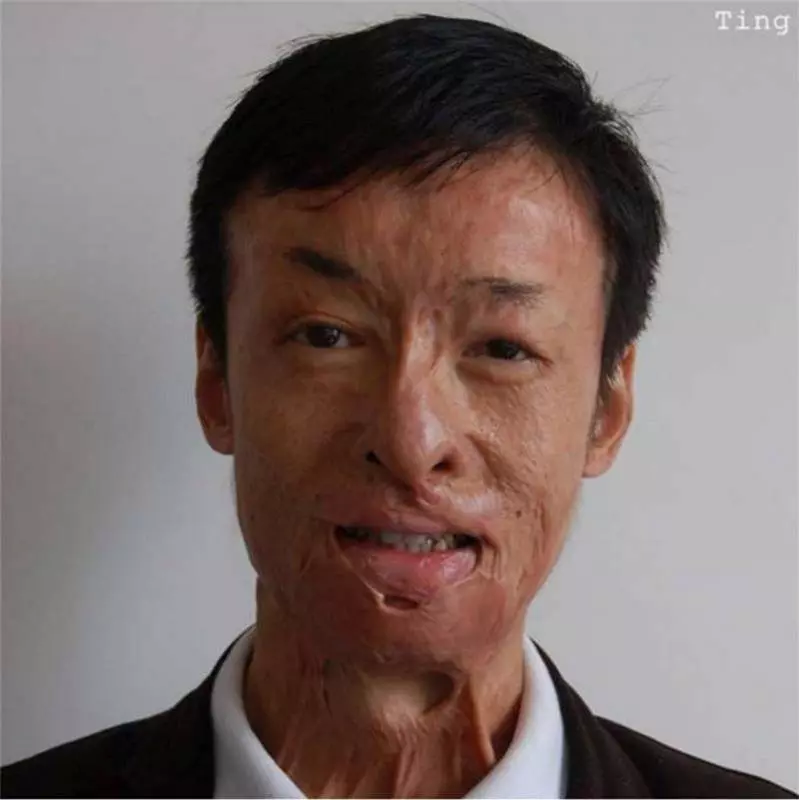 兩次沖入火場救出13條鮮活生命卻慘遭毀容,21歲小夥只能街頭賣唱,沒想到命運從此改變,得到了完美回報