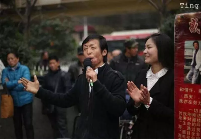 兩次沖入火場救出13條鮮活生命卻慘遭毀容,21歲小夥只能街頭賣唱,沒想到命運從此改變,得到了完美回報