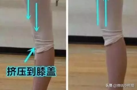 闢謠:深蹲真的傷膝蓋嗎?其實元兇是這3種動作